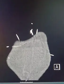 #radiology #fyp #nursetok #nurse #fy 