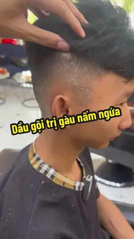 Ae bị gàu gội này nhanh hết lắm #youthology #daugoiyouthology #trigau #namdadau #gàu_ngứa 