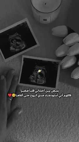 :اللهم كما أنعمت فتمم 🤍🦋 .#حوامل_كيوت #fypシ #CapCut 