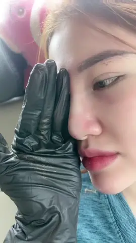 Nâng mũi chỉ là gì? Và ưu nhược điểm là gì? Mời các bạn thả cmt để Nhà Vy beauty tv cụ thể hơn nhé! #NhàVyBeauty #nângmũichỉ #thẫmmỹ #filler #botox #ilovetiktok 