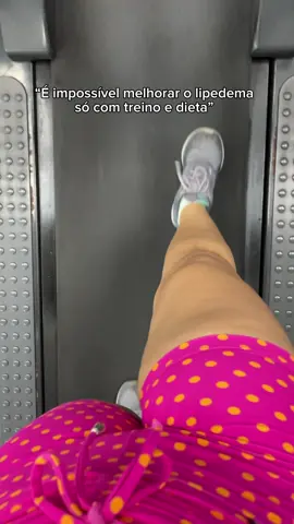 É claro que depende do estágio de cada um, mas o meu estava num estágio 2 e consegui bons resultados me dedicando MUITO aos treinos de musculação, aeróbicos e alimentação!  Esse resultado foi alcançado no período de 1 ano, mas vale lembrar que antes de chegar no estágio 2 do lipedema eu sempre fui uma pessoa que treinou! Tenho 14 anos de treino, então se você nunca se exercitou e está buscando melhorar agora, lembre-se que vai levar um tempo, mas vai dar certo 🤍 programa de treinos na bio ✨ . #lipedema #antesedepois #treinofeminino #Fitness #academia