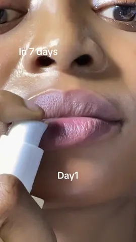 7-day Retinal lip transformation @KSECRET GLOBAL 	 #KSECRETGlowChallenge #KSECRET #Seoul1988 #PigmentationCare 