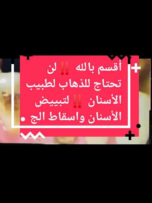 أقسم بالله ‼️لن تحتاج للذهاب لطبيب الأسنان ‼️لتبييض الأسنان واسقاط الجي#متابعه #اسبانيا🇪🇸_ايطاليا🇮🇹_البرتغال🇵🇹 #الشعب_الصيني_ماله_حل😂😂 #اكسبلوررررر #لايكات 