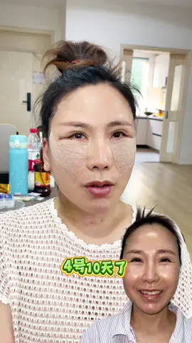 War are from in China .#facelift #faceliftmakeup #整形 #整形外科 #拉皮