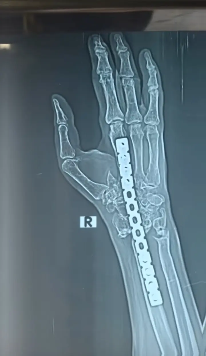 a mona boksir mona Nahi ha  🙏🙏🙏💘💘❤️😭😭😭😭😭💝💝💔💔😭😭😭😭😭😭😭😭😭😭💝❤️❤️💘💘💘💘🙏🙏🙏