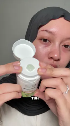 gabisa sembarangan pake moisturizer di acne & oily skin! #moisturizer #msglow #moistacne 