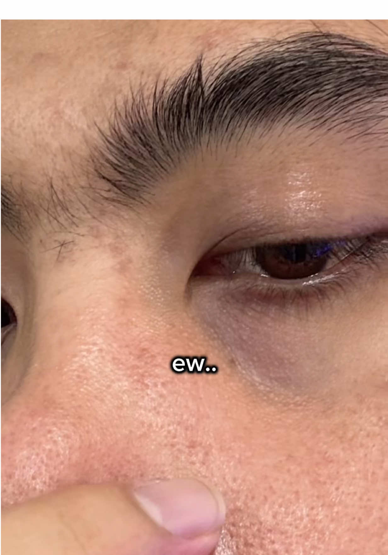 Terlicinn memang jadinya kulit wajah ini ✨✨
