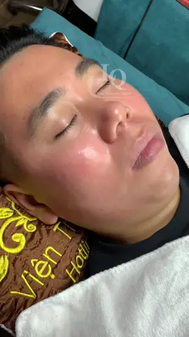 Cập nhật da sẹo nám đinh #chamsocdaseo#chamsocda#chamsocdamun#chamsocdanam#tanbinh      