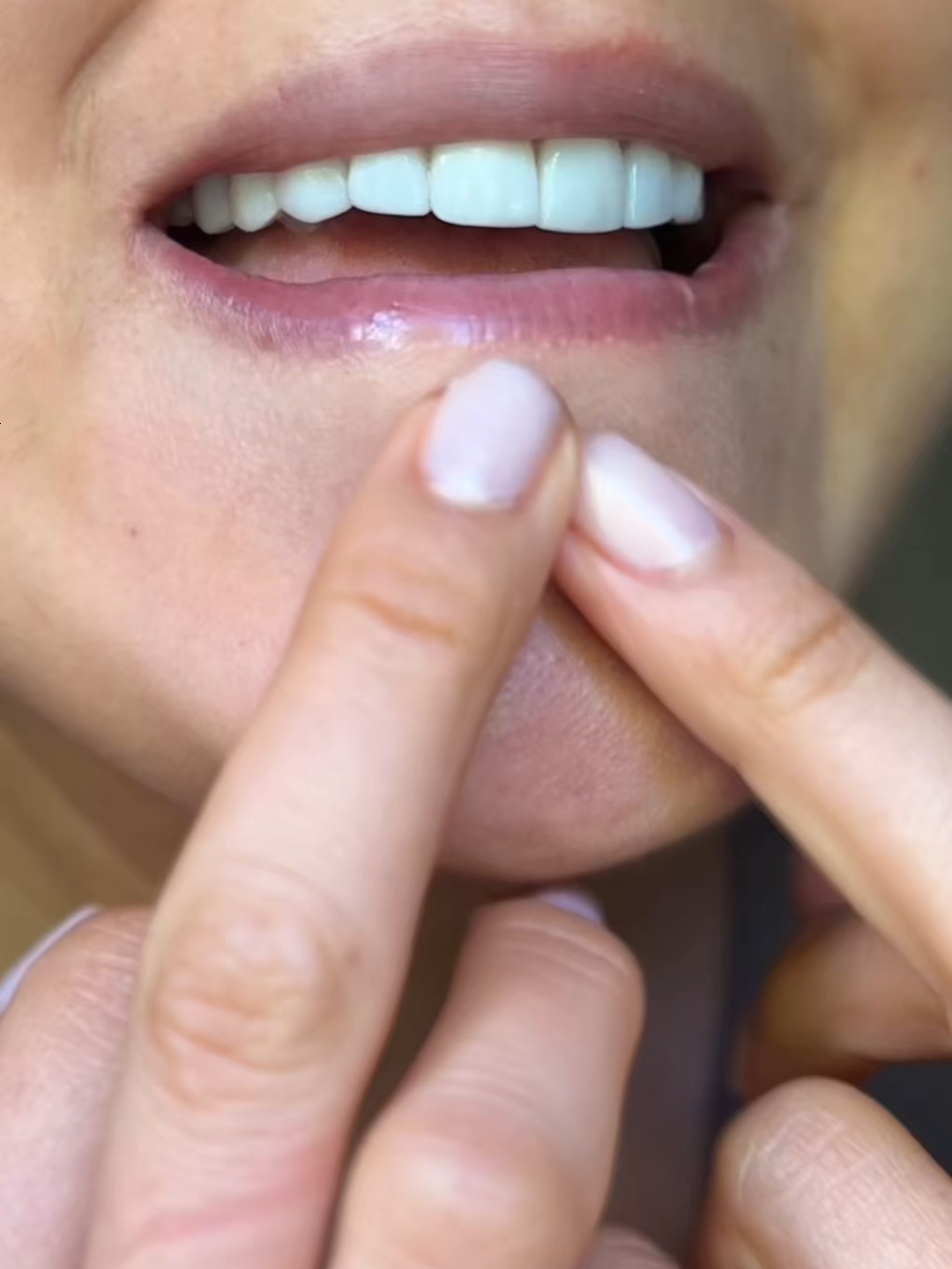 🌟 Por fin algo que cierra poros y borra puntos negros.