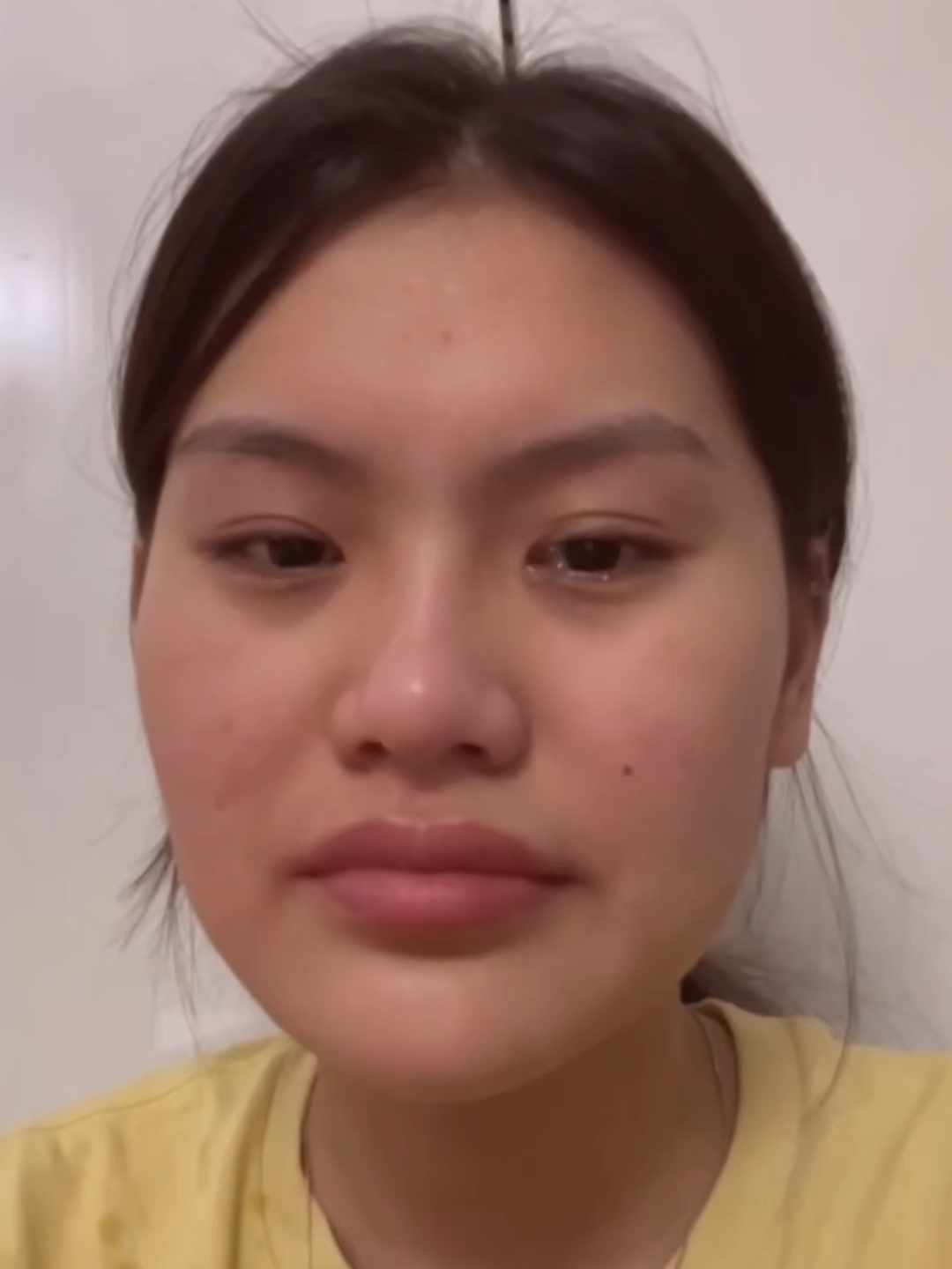 vết chân chim xuất hiện, đâu là giải pháp? #boncept #boncept_vn #retinol