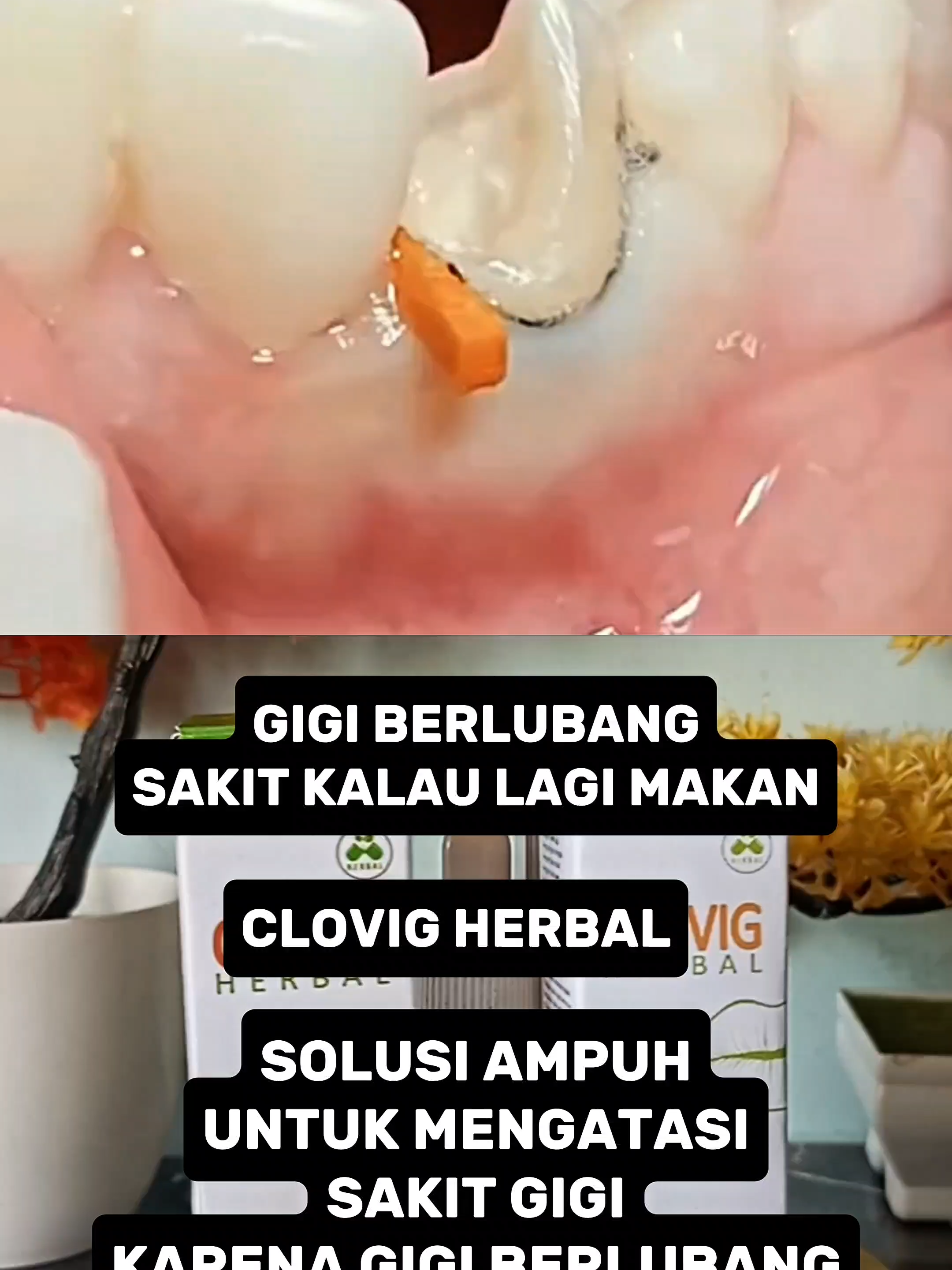 Gigi Ngilu? Baru Makan Dikit Udah Nyut-nyutan? 😖🦷 Sakit gigi bisa bikin aktivitas kacau — makan nggak enak, tidur terganggu, kepala jadi panas! 💧 Clovig Obat Tetes Sakit Gigi – Tetes Sekali, Nyeri Pergi! Langsung tetes di area gigi yang sakit, dan rasakan efeknya bekerja cepat meredakan nyeri. ✨ Keunggulan Clovig: ✅ Meredakan nyeri & ngilu secara cepat ✅ Mudah digunakan, cukup ditetes ✅ Praktis & bisa dibawa ke mana saja Langsung cek di keranjang kuning dan dapatkan harga spesial hari ini. 👉 Klik keranjang kuning sekarang sebelum kehabisan!#fyp #keranjangkuning #Obatsakitgigi