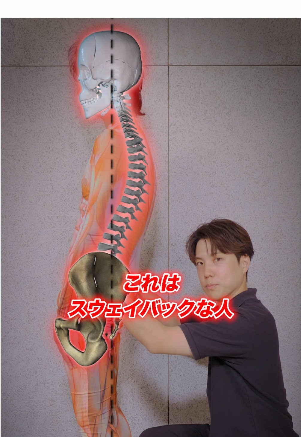 こんな姿勢になっていませんか？ #腰痛 #猫背 #背中 #肩こり #スウェイバック 