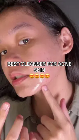 Cocok banget dipakai tiap hari, bahkan buat kulit sensitif 🫶 @LABORE  #laboreskinexpert #Microbiomeinteligence #Microbiome #skincarepintar