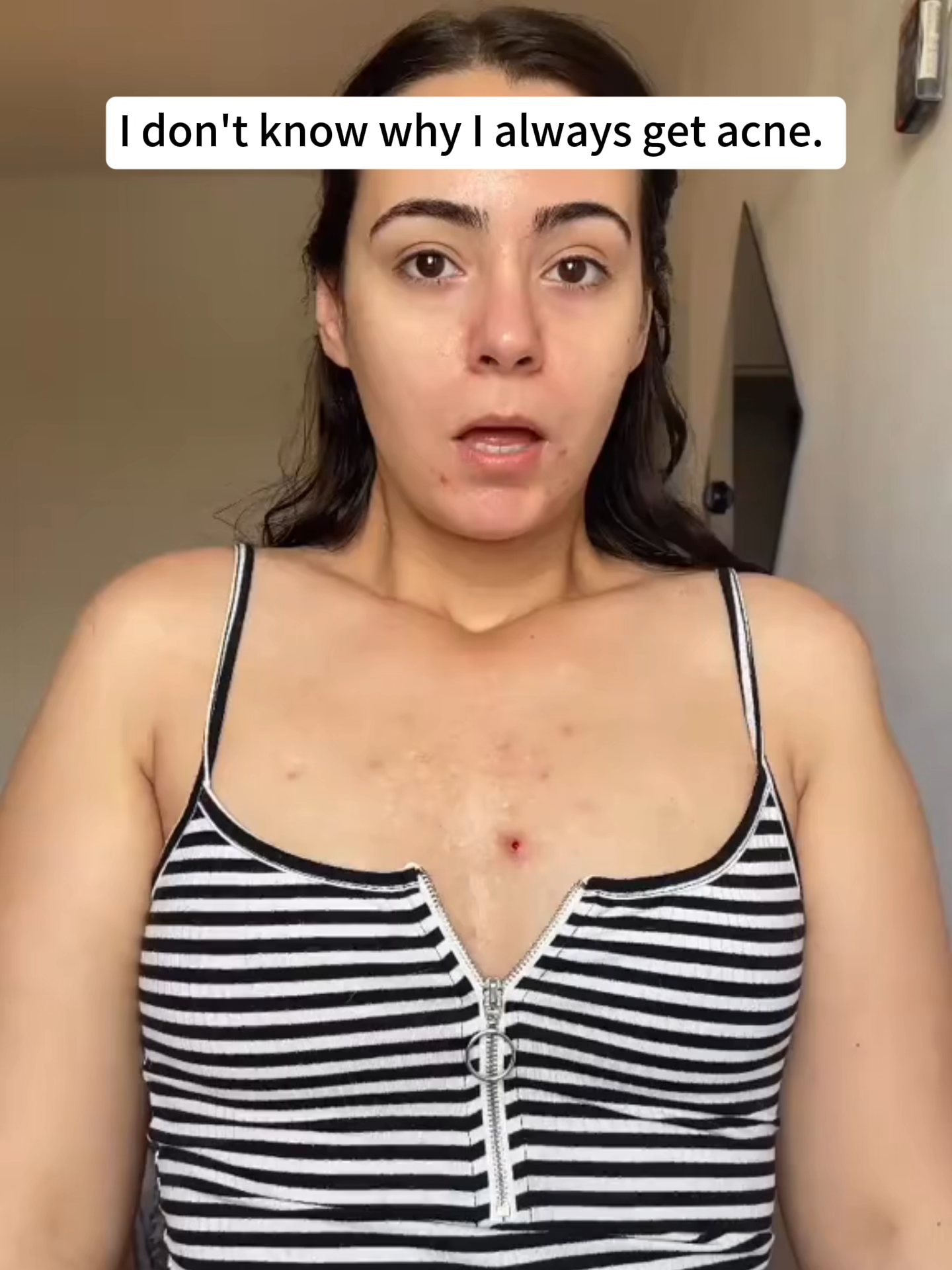 I don't know why I always get acne. #quarxery #fyp #acne
