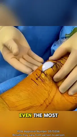 Can you believe this patch beats bone pain so fast?! 🔥#PainPatch #HealthyLiving #pain #DRMITSUI #ZL