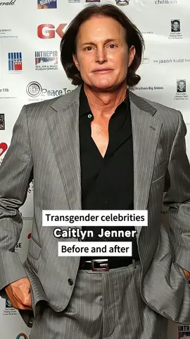 Transgender celebrities,before and after.#fyp #usa #celebrity #transgender #fy 
