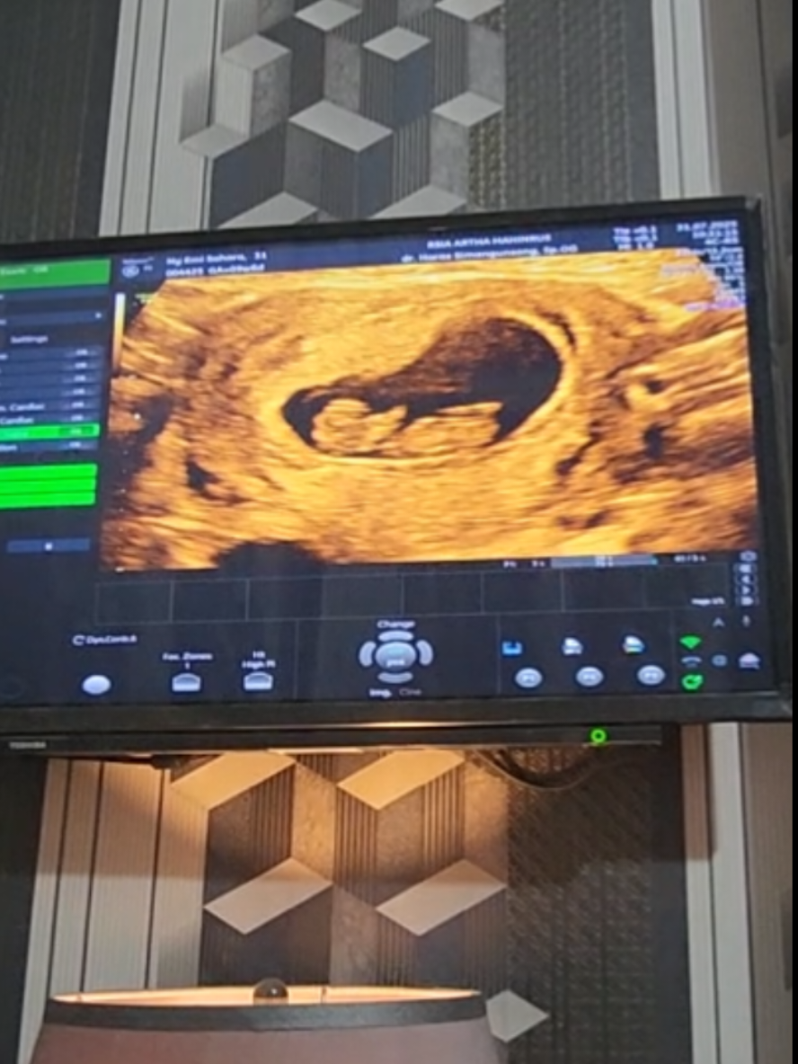 masyaallah tabarakallah 😇 Semoga nanti lahir sehat & lengkap semua tidak ada kurang 1 pun ya nak🤲 jadi anak yang soleha/soleh🥰 #usg  #pregnant  #fypシ  #tm1  #bumilsehat 