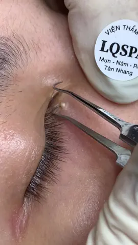 Rớt nước mắt#chamsocdaseo#chamsocda#chamsocdamun#chamsocdanam#tanbinh       