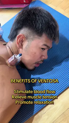 Madami pala talagang benefits ang pag ventosa o cupping therapy #fyp 