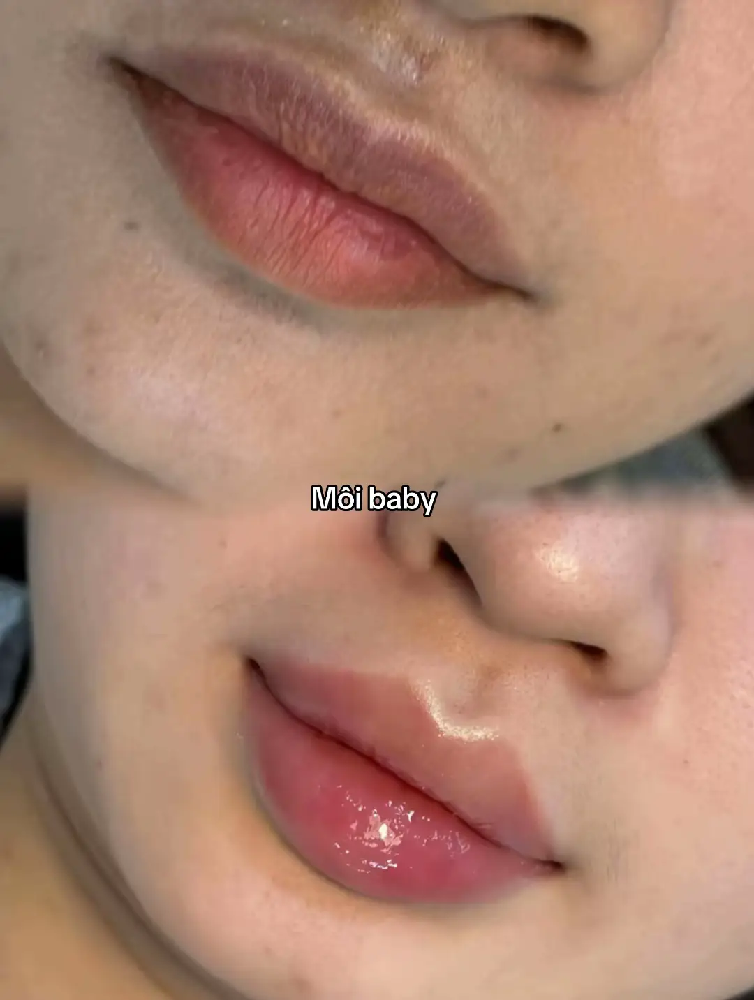 Xinh nhắm mấy bà ơi #filler #môi #xh 