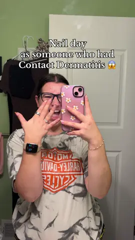 Almost a full year later and my nails and skin are thriving after Contact Dermatitis 😱❤️  DIY Nail Tips #contactdermatitis #contactdermatitissolution #contactdermatitisgirl #diynailsathome #diynails 