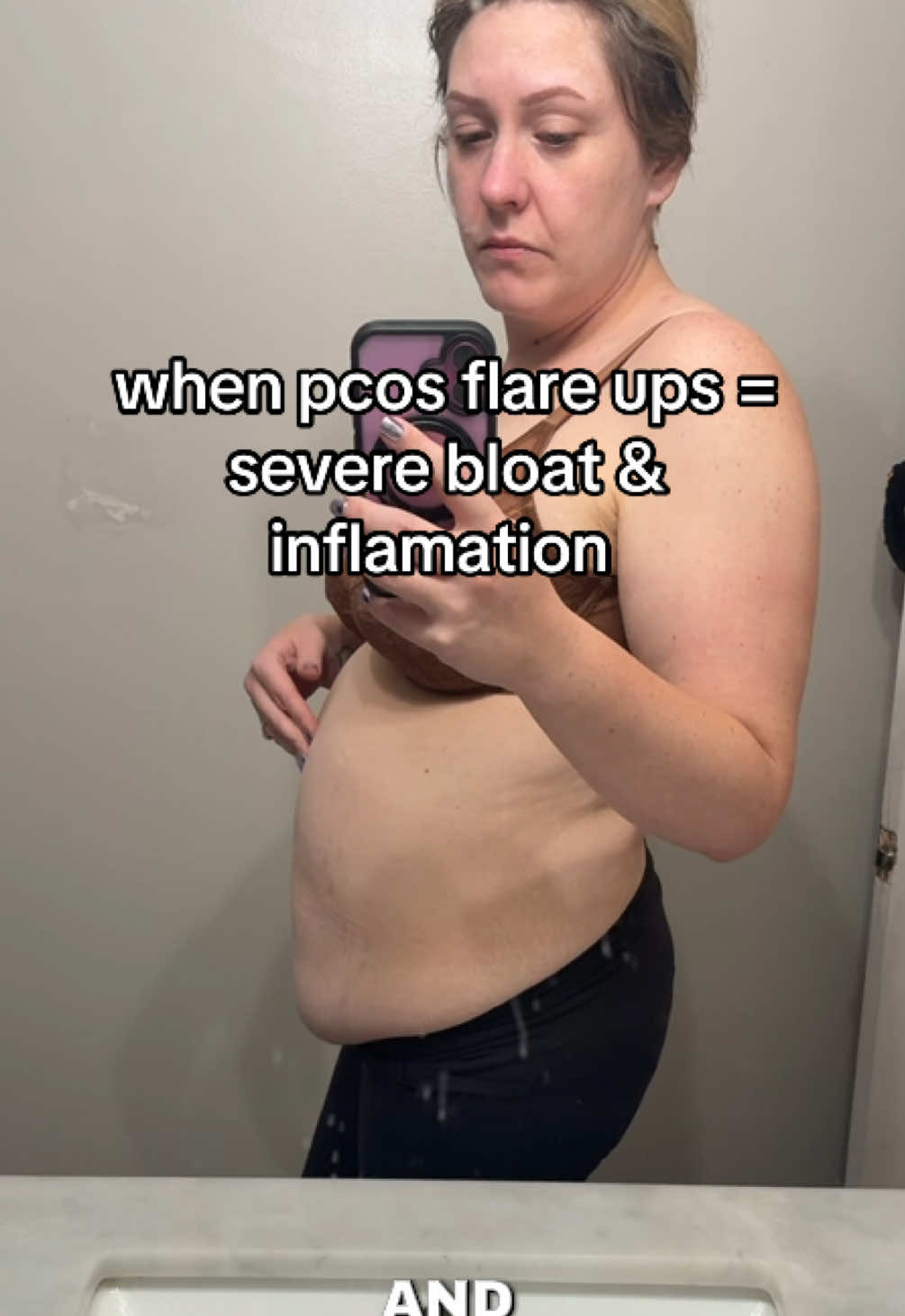 If you struggle with PCOS, perimenopause, menopause, hormonal imbalances, Happy V is an all in 1 (with myo & dchiro inositol) that’s worth checking out!  #happyv #tiktokshopnewarrivals #tiktokshoprestock #newarrivalsurge #hormonalimbalance 