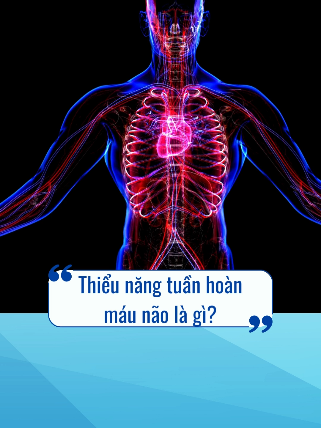 Thiểu năng tuần hoàn máu não là gì? #kinhvuongnaobo #thieunangtuanhoannao #suygiamtrinho #suygiamchucnangnaobo #sasuttritue #dichungnao #alzheimer #matngu