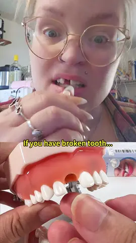 Confident smile starts with dental gel. #fpy #dentures #falseteeth #moldablefalseteeth #teethreplacement #tiktokshop #veneerteeth #cavityfillings 