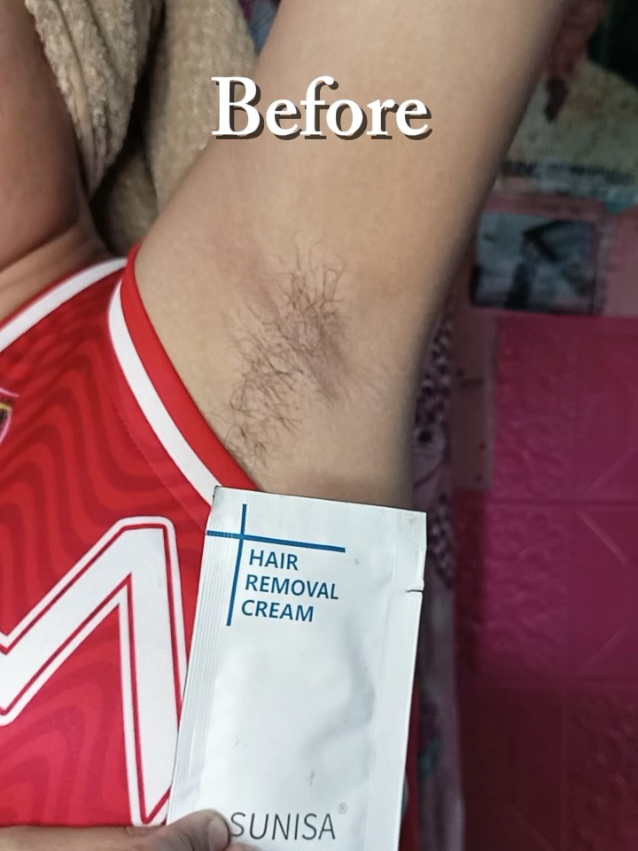 ✨“Makinis na kili-kili in just 5 minutes! ✨  Goodbye balahibo, hello confidence! Subukan na ang Sunisa Hair Removal Cream at maramdaman ang gandang walang sabit