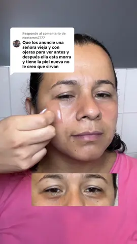 Respuesta a @noetorres7777 Y como ven, funcionan igual: ayudan a desinflamar, reducen las bolsitas y aclaran la zona de las ojeras. Estos parches no tienen edad, sirven para cualquier piel.” @COSRX US @COSRX Official #TikTokShopRestock #ojeras #bolsasenlosojos #ojerastips #parchesdehidrogel 