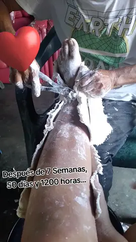 Por fin, ya mi padre me quita el yeso por orden médica, gracias a Dios 🙏🏻 #fracturadetobillo #maleolo  #yeso #recuperacion #graciasdios 