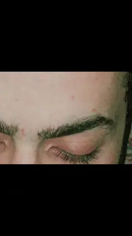 میں ٹھیک ہونا چاہتا ہوں مگر میرا ذہنی توازن اس قدر خراب ہو چکا ہے کہ میں چاہ کر بھی پہلے جیسا ایک نارمل انسان نہیں بن سکتا🥲🖤#A #unfreezmyaccount #foryourpage #foryou 