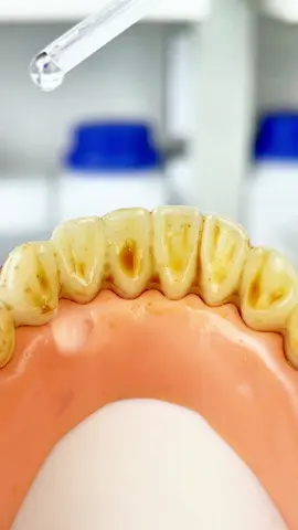 Tidak ada masalah jika Anda berusia 10 atau 60 tahun,🦷💎Bau mulut, Karang gigi, gigi kuning, gusi inflamasi? Menyelesaikan Masalah Anda dengan pasta gigi niacinamide ini # fsmile # gigi # whitening # sensitif # smile # oral # higieneoral # Dental # pemutih gigi # Dental