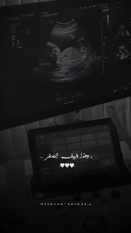 #CapCut #اللهم_صلي_على_نبينا_محمد #الحمدلله_دائماً_وابداً #لايك__explore___ #الله_يهدينا_ويهديكم_ويثبثنا_على_طاعته🖤 