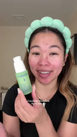 This serum has already become a holy grail of mine 🫡 @Caudalie @Sephora #CaudaliePartner #Caudalie #acne #acneserum #skincare 