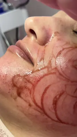 #beauty #kuwaity #skincare #الشعب_الصيني_ماله_حل😂😂 #هاي_بيوتي 