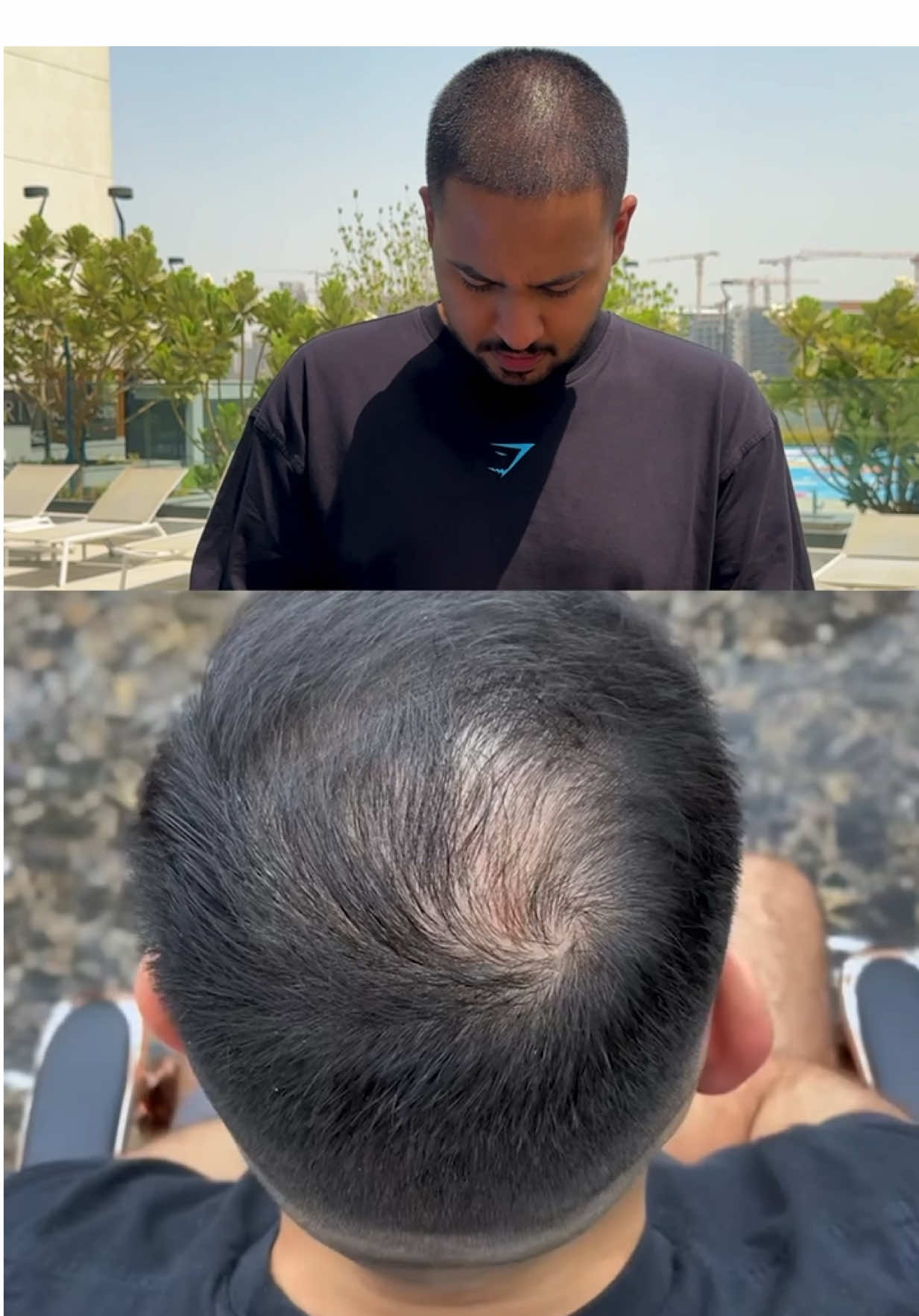 The easiest hair loss fix you’ll ever try! Link in bio. 🧡 #HairBear  #hairloss #hairfibers #hairtransplant #minoxidil 