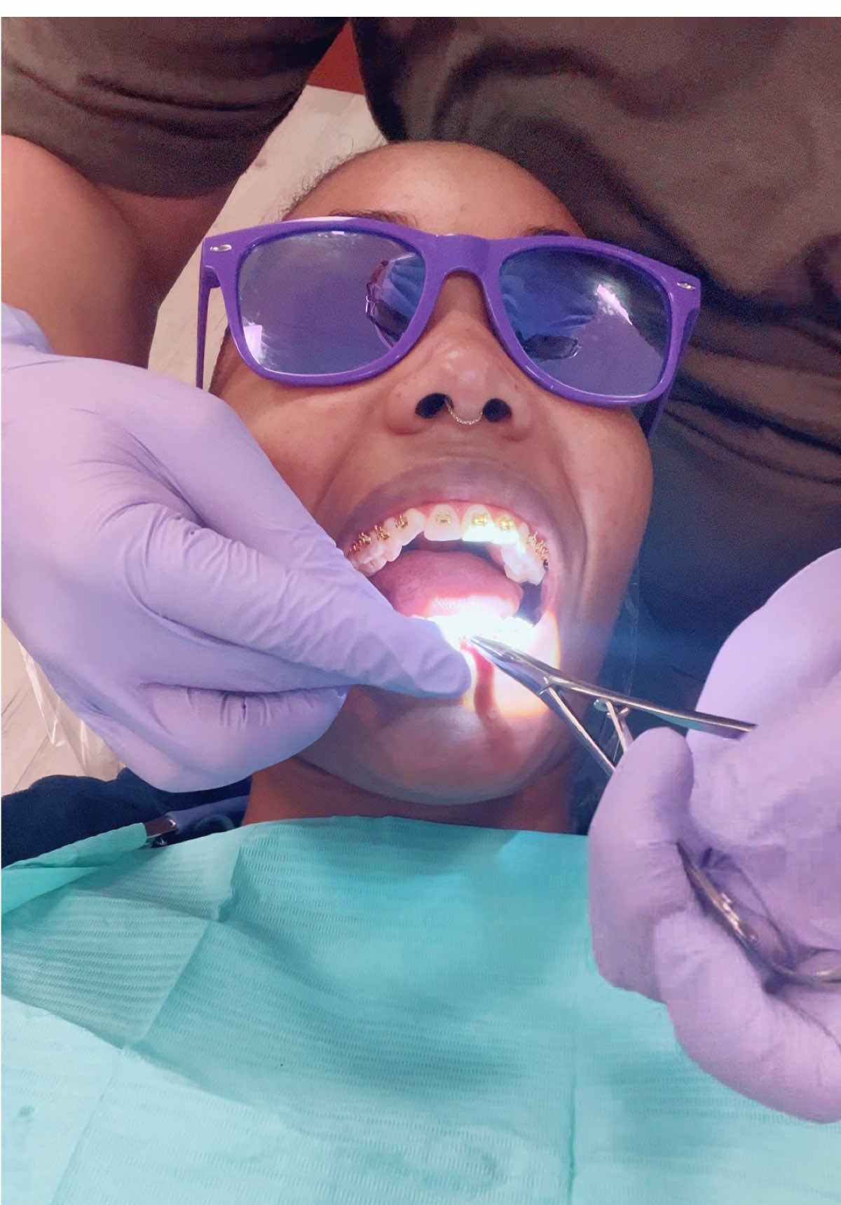I did a thing!! And they actually look so cute! 🤭 #goldbraces #adultbraces #braces #fypp 