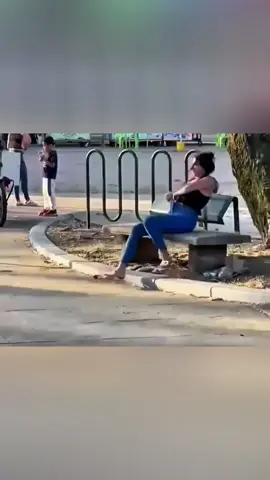 This girl thought an insect had bitten her lip while she was sleeping. But what the doctors discovered next would surprise her.  #truestory #storytime #uktiktok 