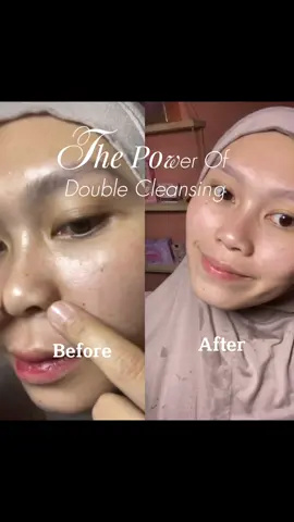 ternyata double cleansing pake cleansing oil itu lebih bersih loh dibanding pake micellar water 😍 #koreanskincare #skin1004id #cleansingoil #doublecleansing #skin1004 