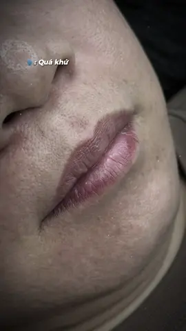 Quên đi quá khứ - xinh đẹp ở hiện tại và tương lai thôi nhé các ce 💋 #vyanhbeauty #tiệmdachữalành #phunmoi #khuthammoi #pmu  #phunxamthammy #xuhuong #CapCut #trending #viral 