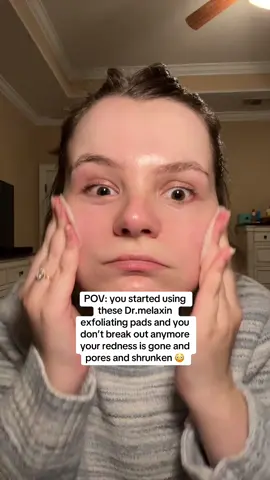 Yall are missing out on these @Dr Melaxin Official exfoliating pads! My skin looks so good since using them! #drmelaxin #exfoliatingpads #exfoliatingproducts #fyp 