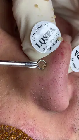 Nồng#chamsocdaseo#chamsocda#chamsocdamun#chamsocdanam#tanbinh       