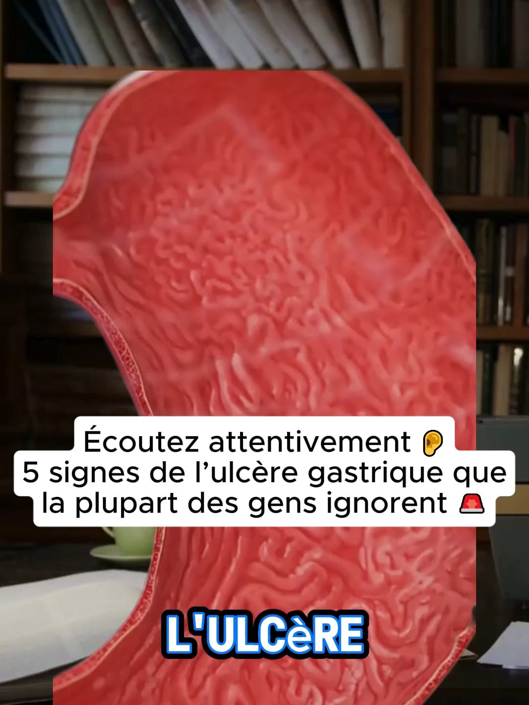Les signes de l’ulcère gastrique que 90% des gens ignorent – solution naturelle pour rester en sécurité #santé #shilajit #nourriture #france