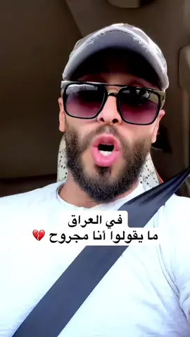 بالعراق ما نقول أنا مجروح #foryoupage #يوسف_البزال #youssef_bazzal #youssefbazzal 