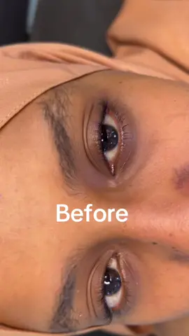 Eye lash lift Eyebrow laminate 0911102652#ethiopian_tik_tok🇪🇹🇪🇹🇪🇹🇪🇹🇪🇹 #foryou #fypシ゚viral🖤tiktok☆♡🦋myvideo❤️❤️🥰🥰 #creatorsearchinsights 