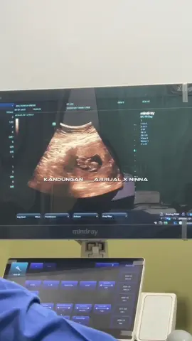 Hallo adek 👋🏻 terima kasih untuk kepercayaan nya sudah hadir di perut mama 🥰 kamu bukan yang pertama tapi kehadiranmu tetap di nanti oleh kami orangtuamu , kakakmu , tantemu , kakek nenekmu , dan senua yang 𝓈𝒶𝓎𝒶𝓃𝑔 denganmu ☺️. Sehat2 ya sayang lahir sehat dan lengkap kami semua menantimu di awal tahun depan ☺️ #anakkedua #adeksayang #penantianbuahhati #penantian11tahun🥰🥰🥰 