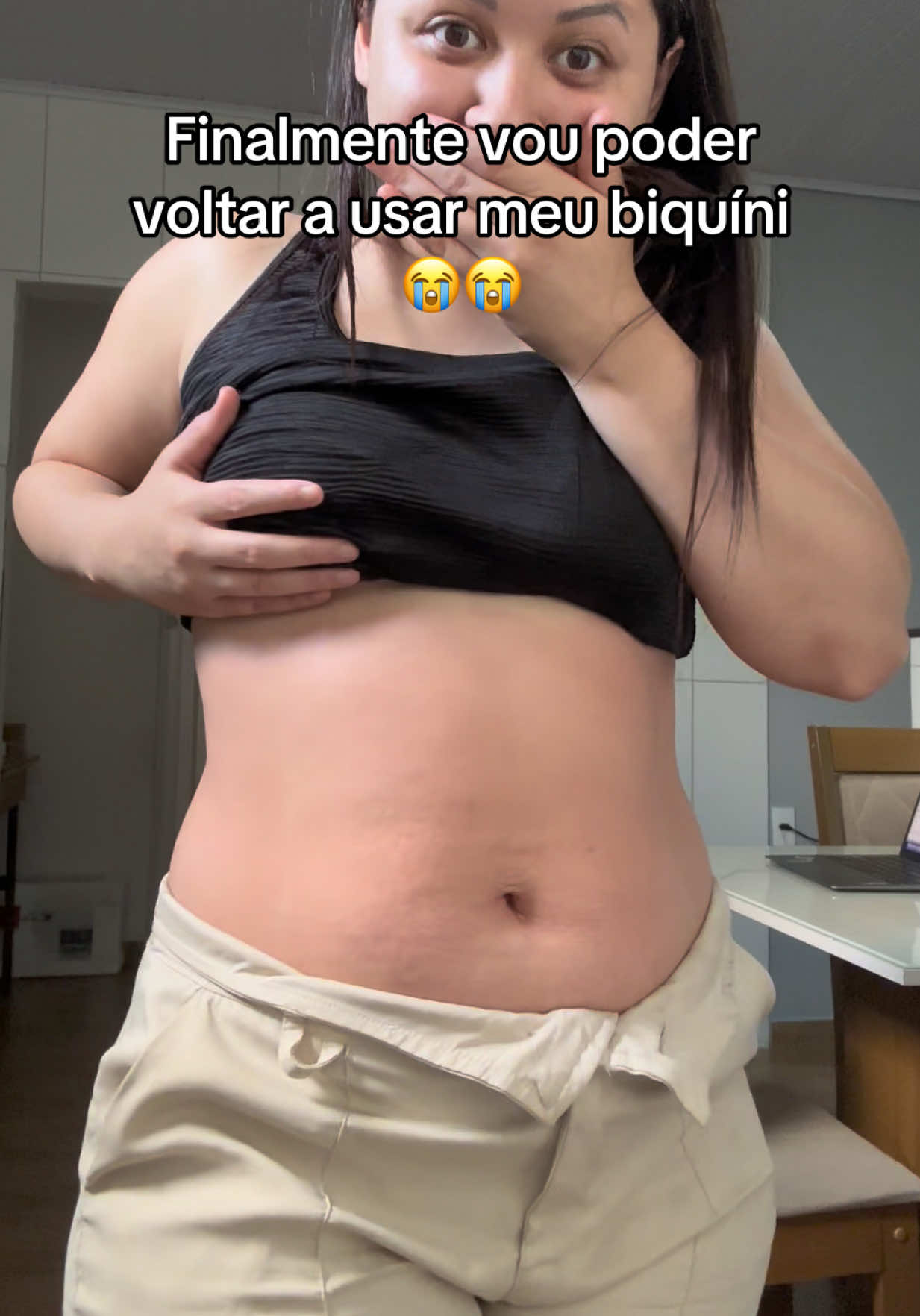Sem acreditar ainda 🥹🥹 #lipedema #estrias #flacidez #celulite #foliculite 