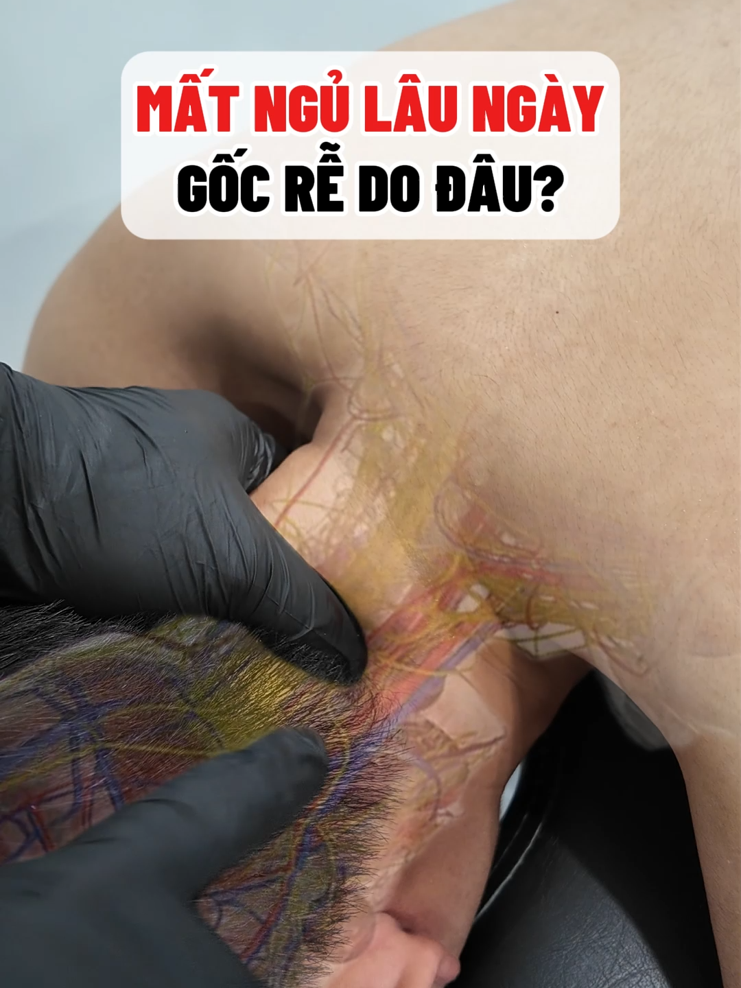 0913 MẤT NGỦ LÂU NGÀYGỐC RỄ DO ĐÂU#lernontiktok #xuhướng #tintam #suckhoe #viral #xuhuong
