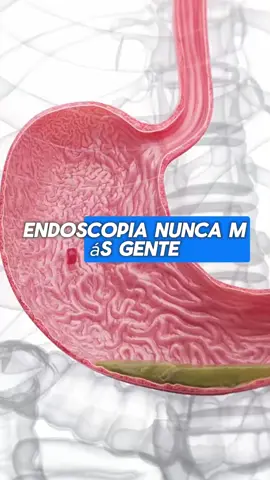 Té casero para gastritis y reflujo #remediosnaturales #saludintestinal #bienestarysalud #vidnatural #unitedstates 